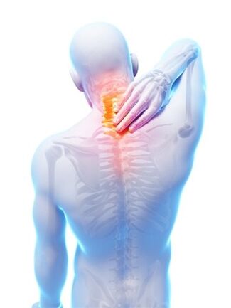Spinal osteochondrosis, kung saan kinakailangan ang Hondrocream