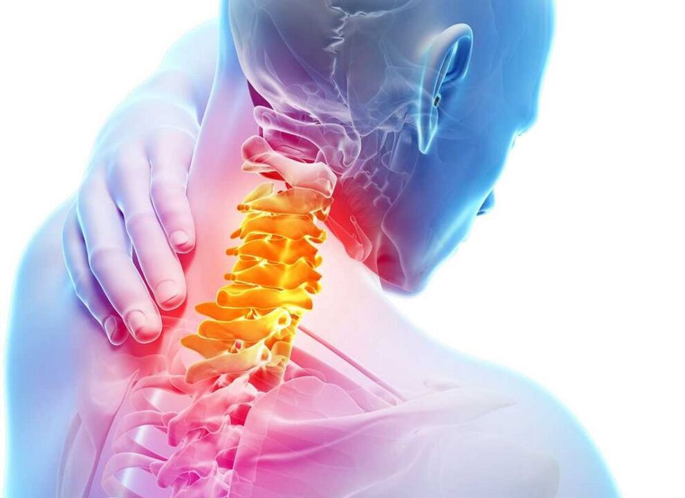 sakit sa cervical spine na may osteochondrosis