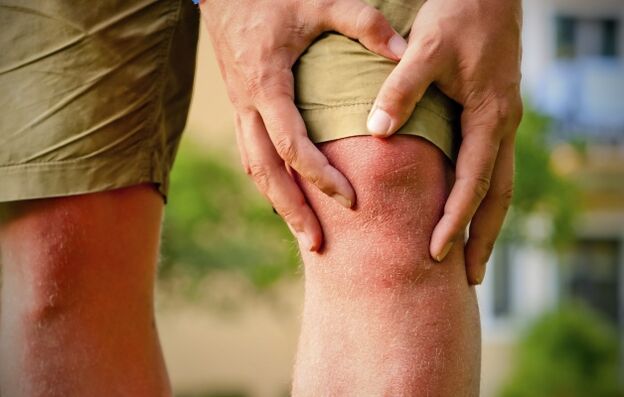 Klinikal na larawan ng arthrosis