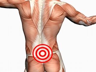 Osteochondrosis ng lumbar spine