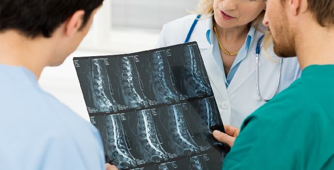 X-ray ng gulugod bilang isang paraan upang masuri ang osteochondrosis