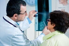 Mga diagnostic na X-ray ng servikal osteochondrosis