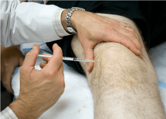 Intra -articular administration ng analgesics sa matinding sakit